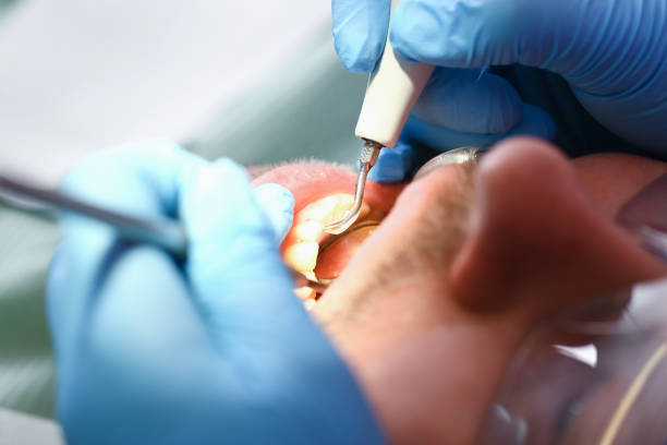 Best Broken or Cracked Tooth Emergency Dentist in Myers Corner, NY