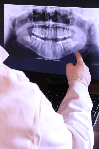 Best Emergency Dentist for Knocked-Out Tooth in Myers Corner, NY